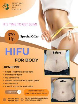 HIFU for Body