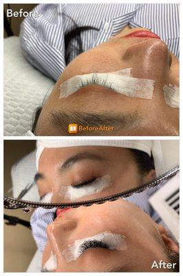 Eyelash extension