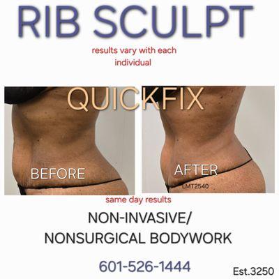 Our new rib sculpt technique is a wood therapy and vacuum therapy service, customized to enhance your upper body