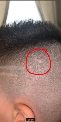 Bald spot