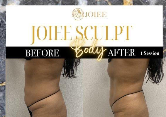 JOIEE STUDIOS SCULPT SESSION