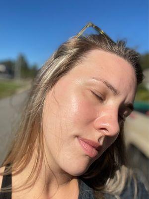 After dermaplaning facial with phskinsolutions.