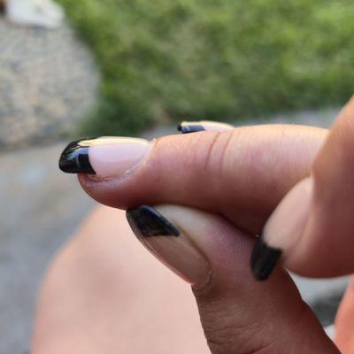 Nail lifting and a white line across the black tip what I assume is trapped file dust