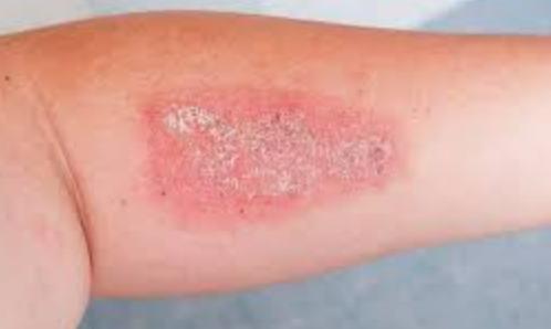 EZ Aesthetics & Wellness