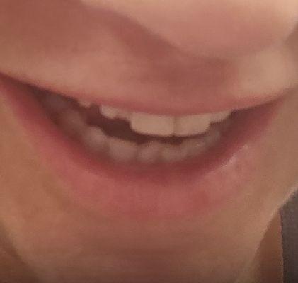 20 hours an out of pocket cash fix.