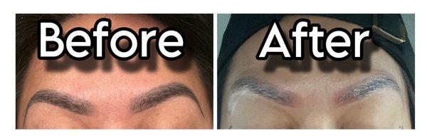 Freedom Laser Hair and Tattoo Removal