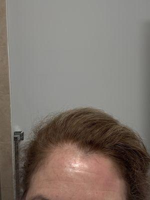 Highlights gone and reddish tones deposited.