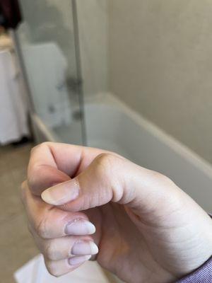 Gel manicure after 2 days, chipped and bubbling up on my thumb