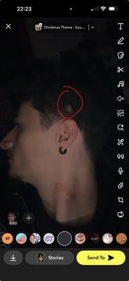 Here is the bald spot.