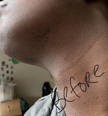 Preferred Image Electrolysis NYC