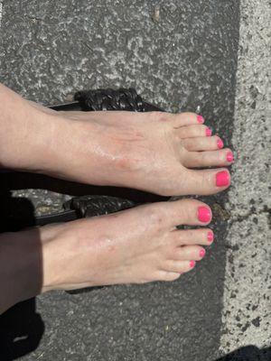 My poor feet