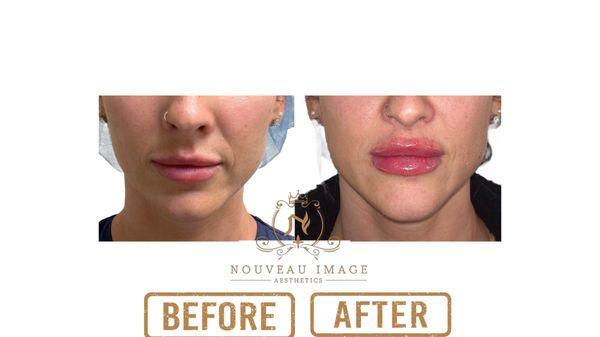 Nouveau Image Aesthetics