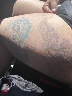 Thigh
