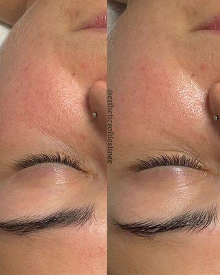 A skincare journey begins!