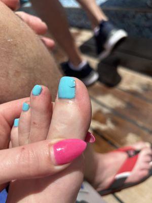 left foot. 3 days later