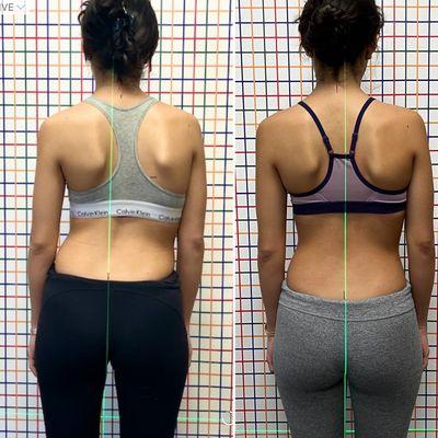 Almonte Physical Therapy & Schroth