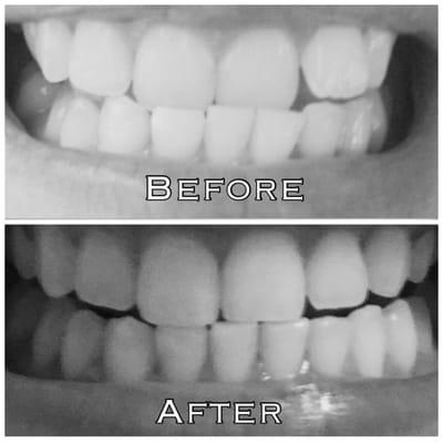 Ora R. Canter, DDS Orthodontics