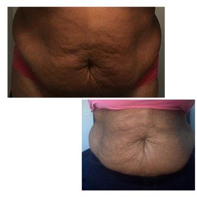 Beyoutiful Body Intentions