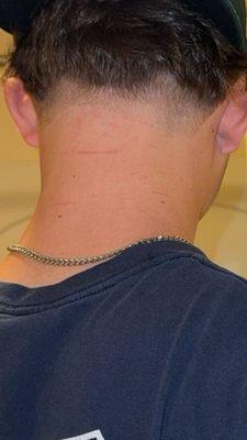 Bad blend, simple low taper. Cuts all over neck.