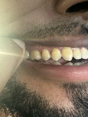 Premiere Orthodontics