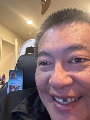 Here is me with my broken tooth