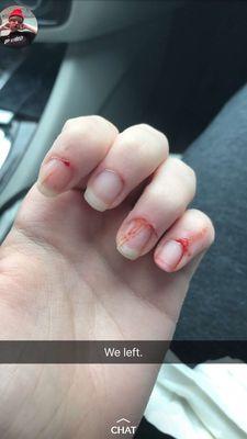 This is what my daughters nails looked like after going to Anna's nails