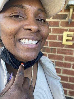 Jazcha strictly whitening by PG.