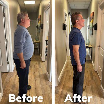 Weight Loss RVA