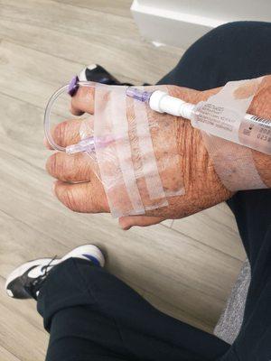 Just prepped waiting for the cardiac pet scan.