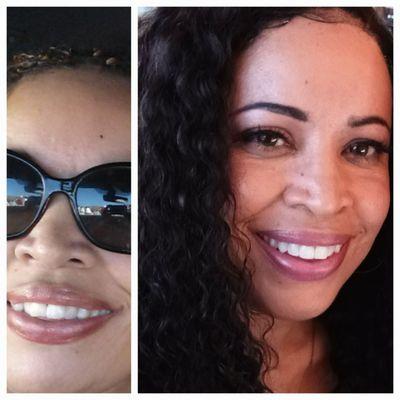 Le Dental Care of Elk Grove