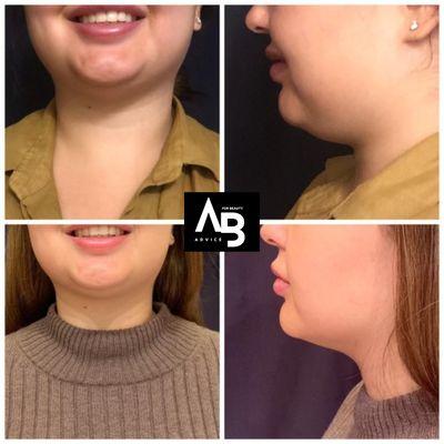 Advice for Optimal Wellness