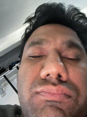 You can see the cut on the nose, he cut the nostrils which are very uneven.