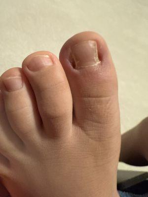 Stewart Foot And Ankle