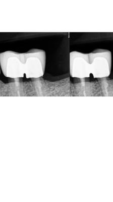 Berkeley Hills Dental Care