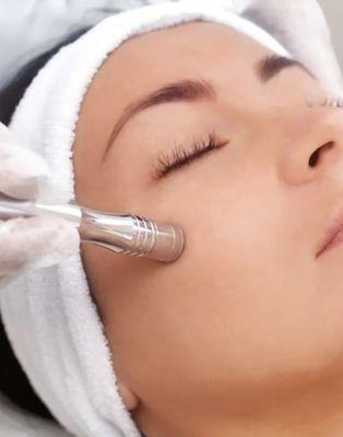 Microdermabrasion facial