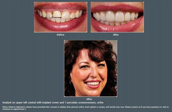 John Cho, DDS - Smile Studio LA