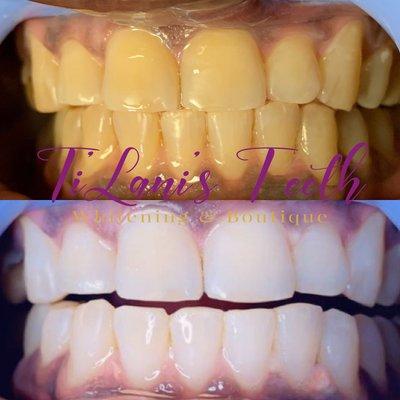 Ti'Lani Teeth Whitening & Boutique
