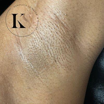 Komplete Skinkare & Waxing