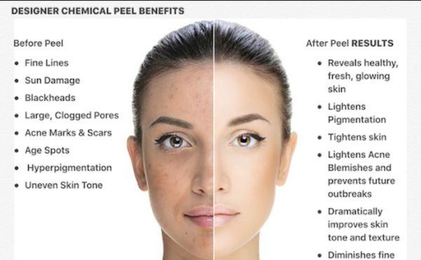 Skin Bar on Broadway