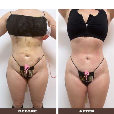 Client Post op package results