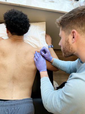 We also offer dry needling and physical therapy