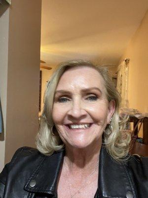 Love my results! Micro needling w/ RF