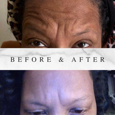 Say goodbye to harsh lines and hello to smooth skin