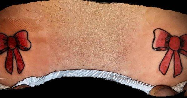 2 little pink bows on the lower pelvic region of a young lady