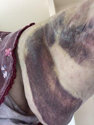 Fresenius Kidney Care -Eugene