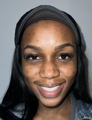 Before starting treatments