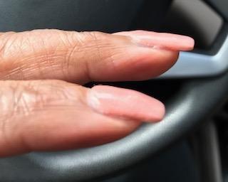 thick, lumpy, powder on tips