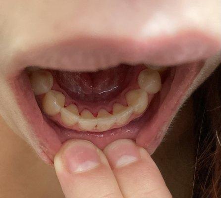 Raffaella Armstrong, DMD