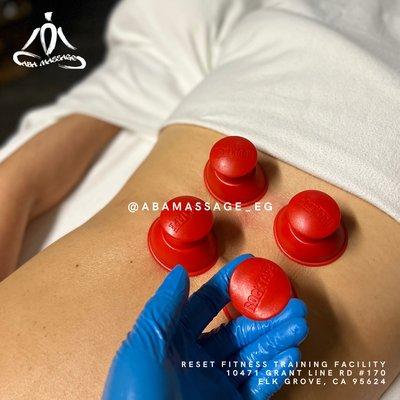 Targeting low back pain and stiffness with cupping therapy.