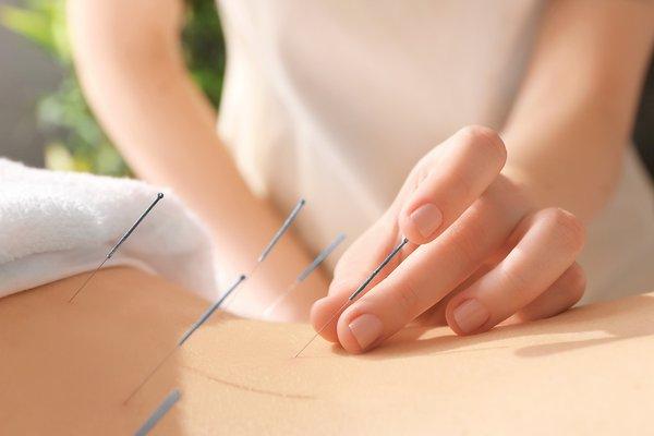 Acupuncture for Trauma, Women's Health, Acute and Chronic pain, and more.